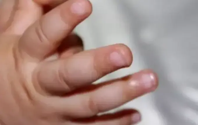 Pai agride bebê que chorava em ambulância em Santa Catarina