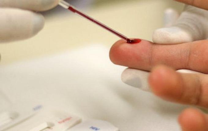 Diagnóstico da Aids cresce em SC, mas número de óbitos apresenta queda