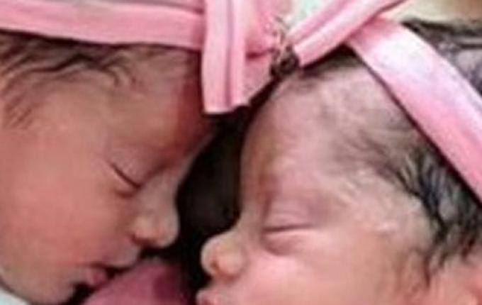 Recém-nascidas gêmeas morrem após serem atacadas por cachorro da família na Bahia