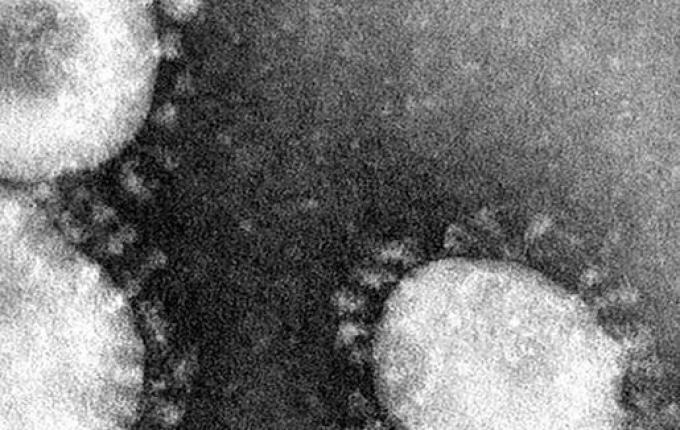 Ministério confirma mais dois casos suspeitos de coronavírus: no RS e no PR