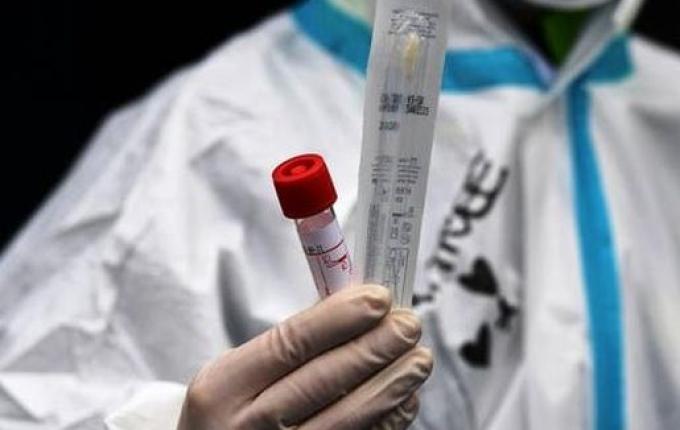 "Somos todos suscetíveis", alerta infectologista sobre coronavírus