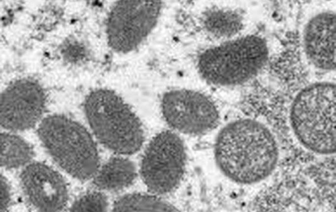 Dive investiga suspeita de caso de varíola dos macacos no Extremo-Oeste