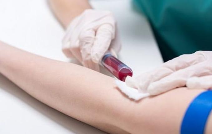 São Miguel do Oeste tem 19 casos de COVID-19 e 4 recuperados