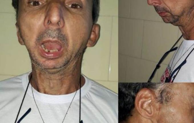 Caminhoneiro de São José do Cedro busca ajuda para realização de cirurgia