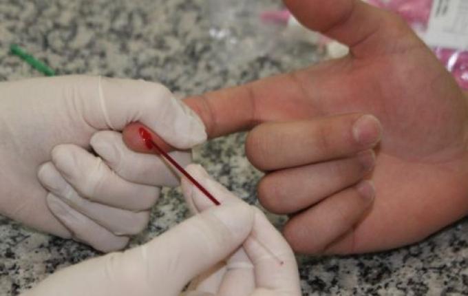 Saúde trabalha na prevenção das Hepatites Virais em SMO