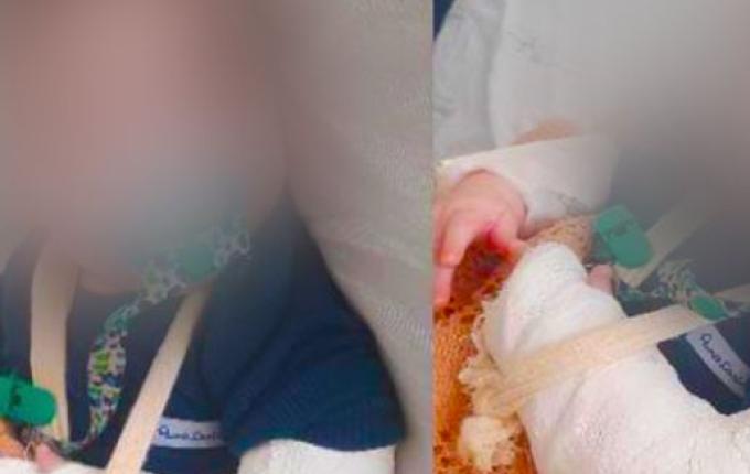 Hospital Regional apura caso de bebê que teve braço quebrado durante internação
