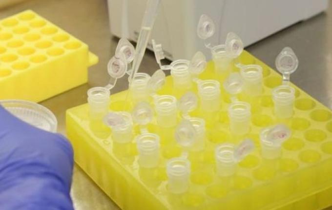 Chapecó registra o primeiro caso de Coronavírus do Oeste