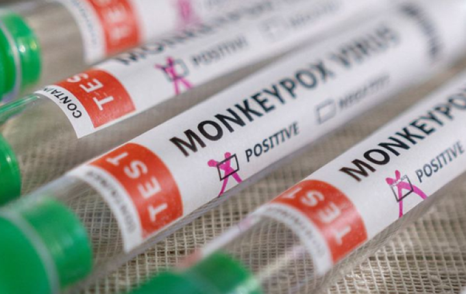 Ministério monitora três casos suspeitos de varíola dos macacos