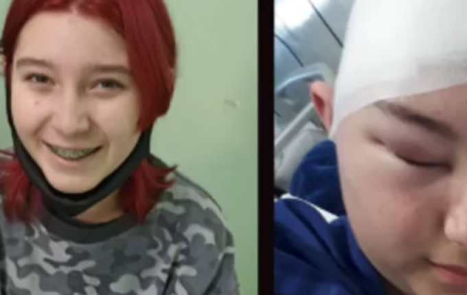 Família de São Lourenço do Oeste pede ajuda para tratamento da filha com câncer