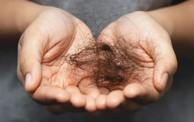 SUS inclui tratamento de câncer sem queda de cabelo que custa R$ 27 mil a sessão no particular