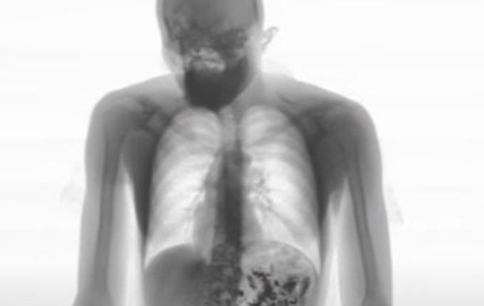 Presos retornam de saída temporária com celulares no estômago e ânus em SP