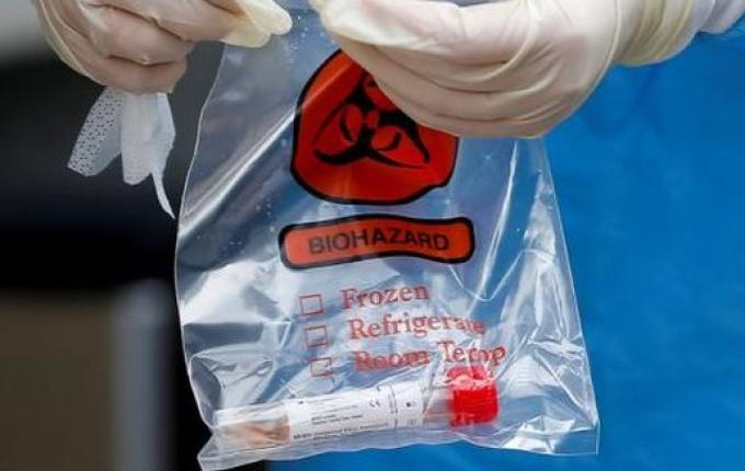 Fiocruz detecta no Paraná novo vírus respiratório com potencial pandêmico