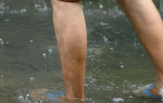 SC tem salto no número de mortes por leptospirose em 2023