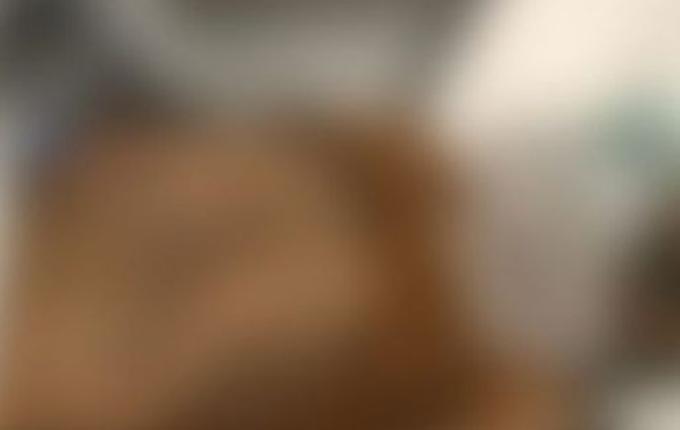 Filho leva pai idoso com pé amputado ao hospital e acaba preso