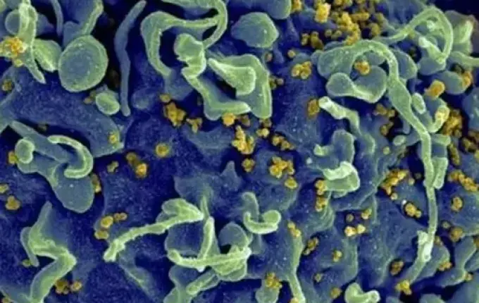 HIV: médicos anunciam 4º caso de cura no mundo