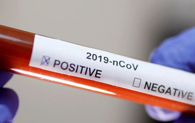 Confirmado 1º caso de Coronavírus em Paraíso