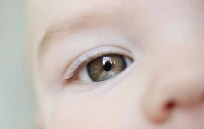 Teste do olhinho deve ser repetido três vezes ao ano até os 3 anos