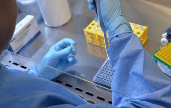 Governo do Estado confirma segunda morte por Covid-19