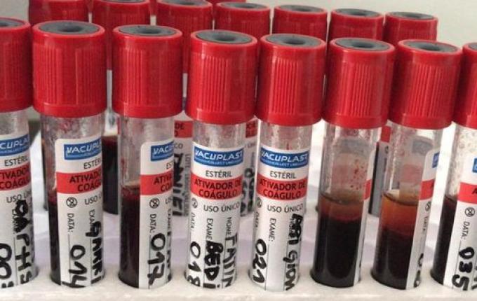 COVID-19: São Miguel do Oeste já testou mais de 650 pessoas