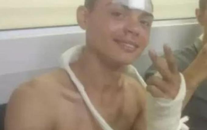 ‘O chão da estrada cedeu’, diz relato de militar ferido em acidente