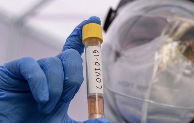 Sobe para 15 o número de casos de COVID-19 em São Miguel do Oeste