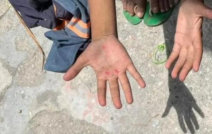 SC é o quinto estado com maior número de denúncias de trabalho infantil do país