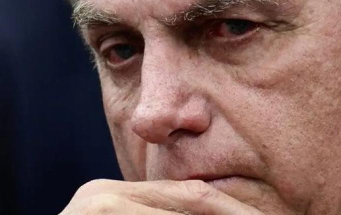 Defesa pede que Bolsonaro seja internado para cirurgia na véspera de Natal