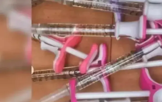 Clínica de estética suspeita de adulterar produtos em SC pode ser multada em até R$ 500 mil