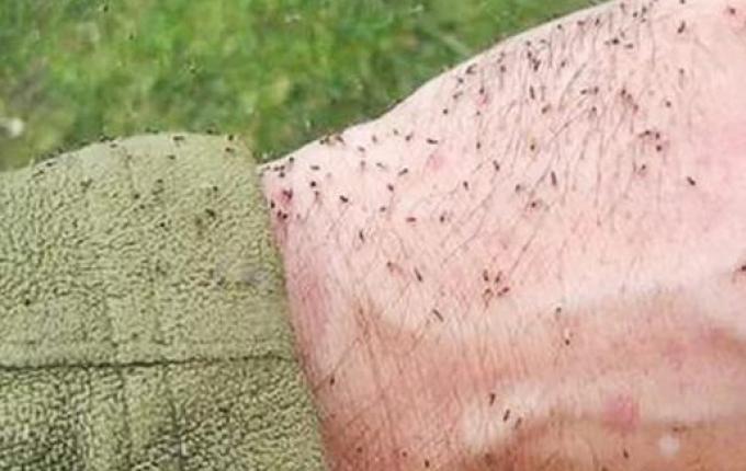 MS investiga primeiro caso de morte suspeita por Febre Oropouche em SC