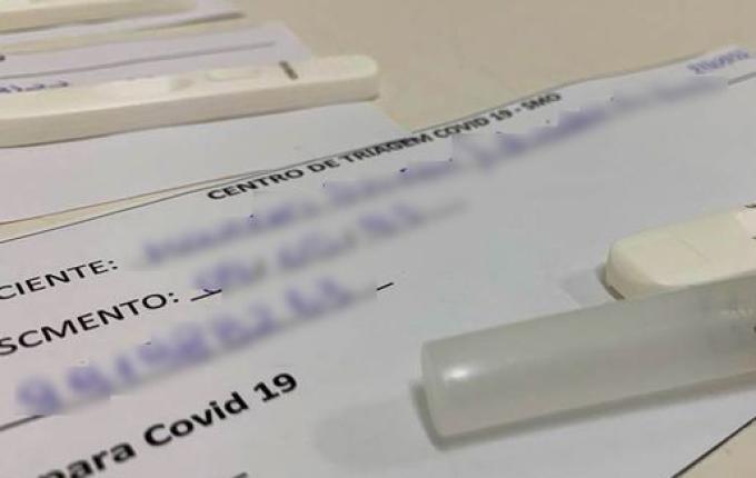 Novos sintomas da Covid-19 são descobertos e diagnosticados