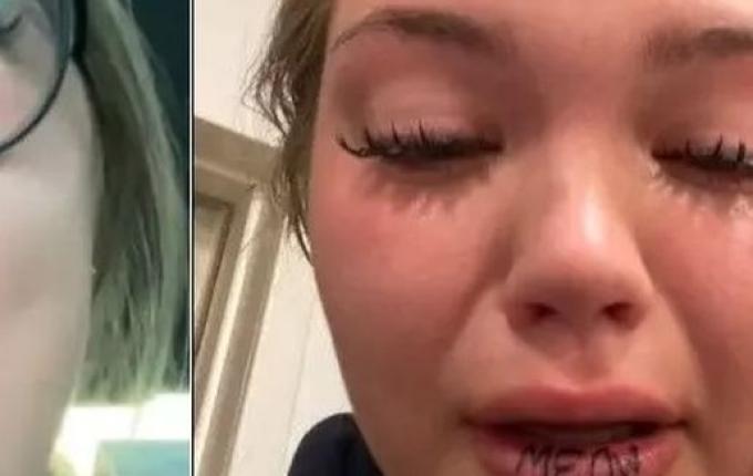 Tatuador erra, e jovem acaba com a palavra ‘miau’ no lábio inferior