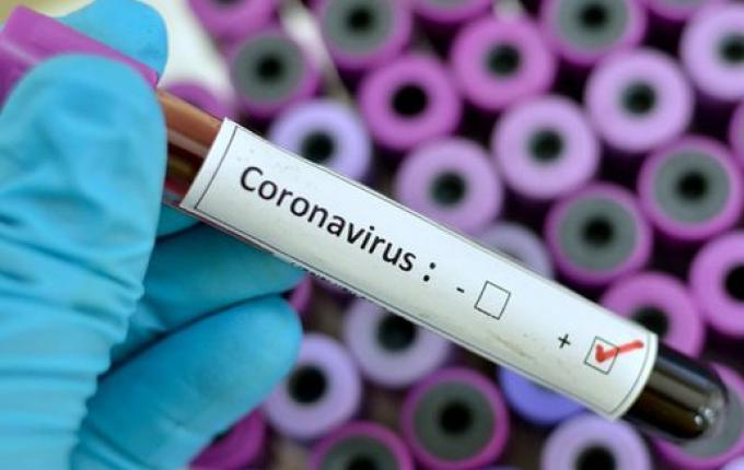 Sobe para 7 o número de casos de Coronavírus em São Miguel do Oeste