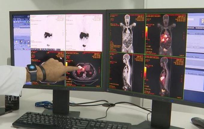 Câncer de próstata tem novo tratamento com radioterapia reduzida