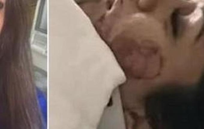 Enfermeira arrisca a própria vida para salvar mulher vítima de violência doméstica