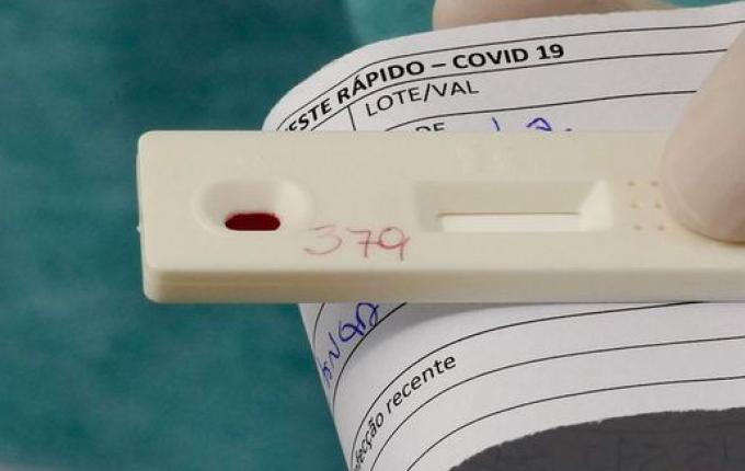 Vital Brazil e UFRJ testam soro para tratar COVID-19