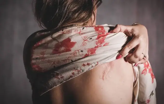 Ex-marido tenta matar mulher a facadas por não aceitar fim da relação em SC