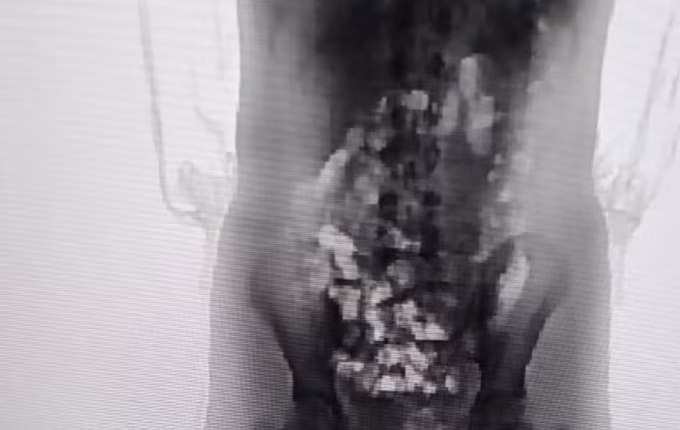 Adolescente de 13 anos é flagrada com 32 porções de droga ao entrar em presídio de Chapecó