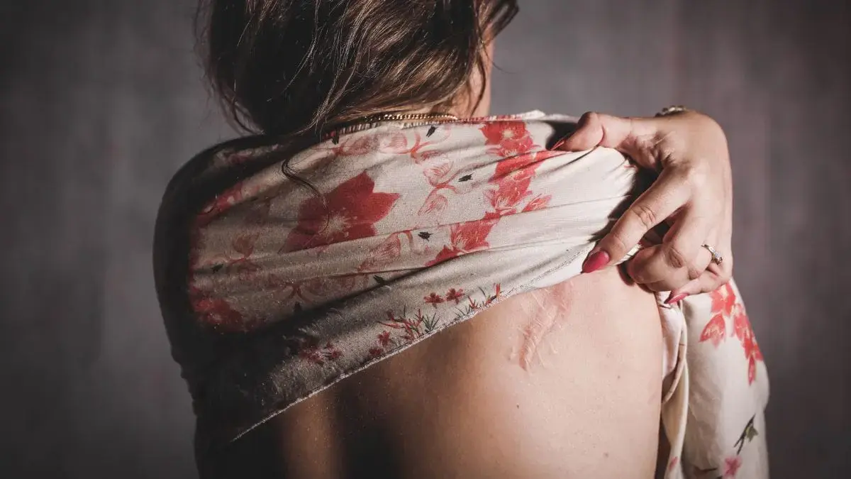 Ex-marido tenta matar mulher a facadas por não aceitar fim da relação em SC